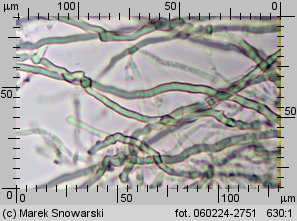 Sistotrema muscicola (wielozarodniczka mchowa)