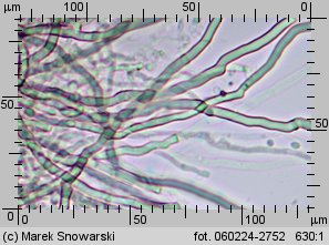 Sistotrema muscicola (wielozarodniczka mchowa)