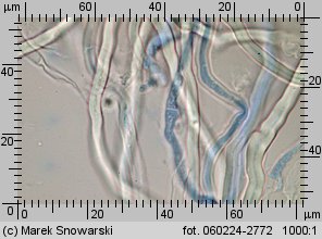 Sistotrema muscicola (wielozarodniczka mchowa)