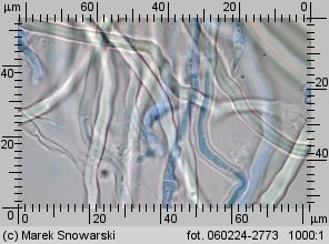 Sistotrema muscicola (wielozarodniczka mchowa)