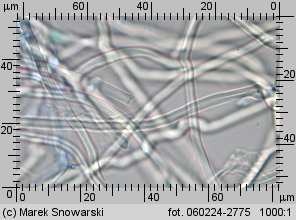 Sistotrema muscicola (wielozarodniczka mchowa)