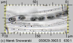 Otidea onotica (uchówka ośla)