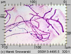 Tremella mesenterica (trzęsak pomarańczowożółty)