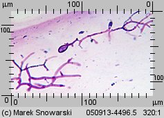 Tremella mesenterica (trzęsak pomarańczowożółty)