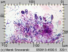 Tremella mesenterica (trzęsak pomarańczowożółty)