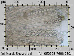 Trichophaeopsis bicuspis