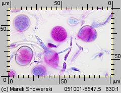 Naematelia encephala (trzęsak mózgowaty)