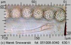 Scutellinia barlae