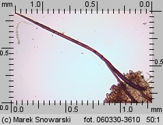 Scutellinia trechispora (włośniczka szorstkozarodnikowa)