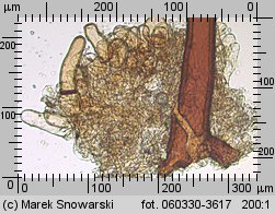 Scutellinia trechispora (włośniczka szorstkozarodnikowa)