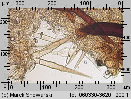 Scutellinia trechispora (włośniczka szorstkozarodnikowa)