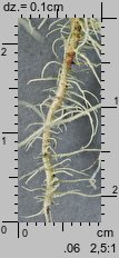 Usnea dasypoga (brodaczka zwyczajna)