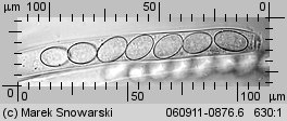 Peziza micropus (kustrzebka drobnotrzonowa)