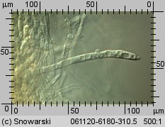 Phlebia radiata (żylak promienisty)