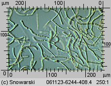 Dacrymyces stillatus (łzawnik rozciekliwy)