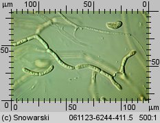 Dacrymyces stillatus (łzawnik rozciekliwy)