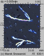 Physcia stellaris ssp. stellaris (obrost gwiazdkowaty)