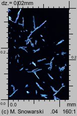 Physcia stellaris ssp. stellaris (obrost gwiazdkowaty)