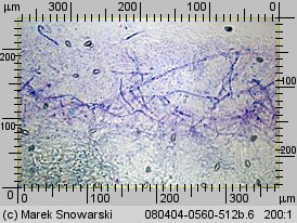 Hebeloma crustuliniforme (włośnianka rosista)