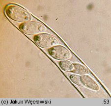 Sclerotinia trifoliorum (twardnica koniczynowa)