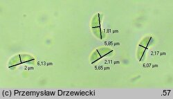 Amyloxenasma allantosporum (żylaczka serdelkowozarodnikowa)