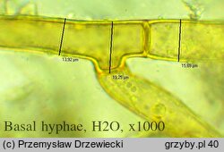 Botryobasidium laeve (pajęczynowiec szerokostrzępkowy)