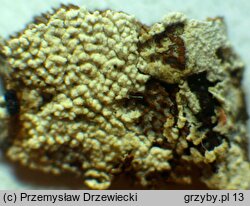 Sistotrema brinkmannii (wielozarodniczka gruzełkowata)