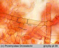 Botryobasidium laeve (pajęczynowiec szerokostrzępkowy)