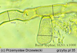 Botryobasidium laeve (pajęczynowiec szerokostrzępkowy)