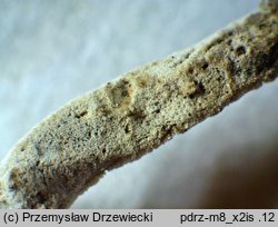 Rhizoctonia fusispora (strzępniczek wrzecionowatozarodnikowy)