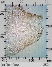 Hyalorbilia microscopica (szklannoguziczka mikroskopijna)