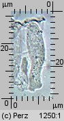 Hyalorbilia microscopica (szklannoguziczka mikroskopijna)