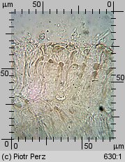 Hyalorbilia microscopica (szklannoguziczka mikroskopijna)