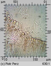 Hyalorbilia microscopica (szklannoguziczka mikroskopijna)