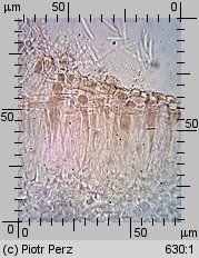 Hyalorbilia microscopica (szklannoguziczka mikroskopijna)