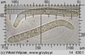 Lasiosphaeria ovina
