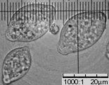 Monilinia fructigena (paciornica owocowa)