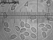 Strobilurus stephanocystis (szyszkówka tęporozwierkowa)